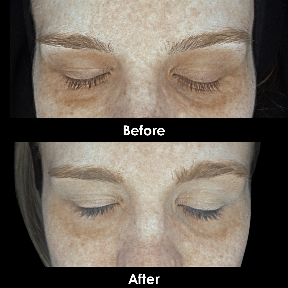 Before and After Eyes