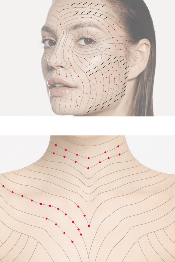 Injection Science: Precision Matters